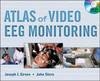 The Atlas of Video-EEG Monitoring - 9780071597425
