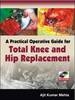 A Practical Operative Guide for Total Knee and Hip Replacement - 9780071634373