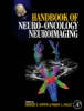 Handbook of Neuro-Oncology Neuroimaging - 9780123708632