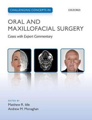 Challenging Concepts in Oral and Maxillofacial Surgery - 9780199653553