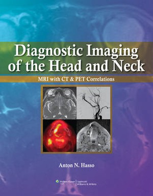 Diagnostic Imaging of the Head and Neck - 9780397515370