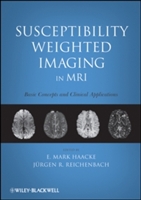 Susceptibility Weighted Imaging in MRI - 9780470043431