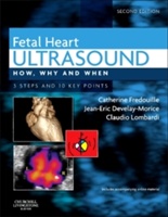 Fetal Heart Ultrasound - 9780702043413