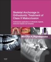 Skeletal Anchorage in Orthodontic Treatment of Class II Malocclusion - 9780723436492