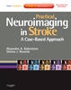 Practical Neuroimaging in Stroke - 9780750675376