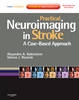 Practical Neuroimaging in Stroke