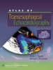 Atlas of Transesophageal Echocardiography