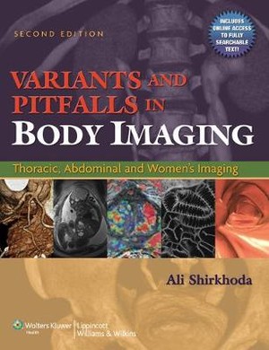 Variants and Pitfalls in Body Imaging - 9780781797887