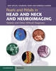 Pearls and Pitfalls in Head and Neck and Neuroimaging - 9781107026643