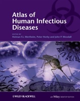 Atlas of Human Infectious Diseases - 9781405184403