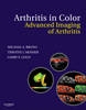 Arthritis in Color - 9781416047223