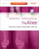 The Knee - 9781416049746