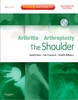 The Shoulder - 9781416049753