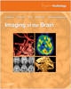 Imaging of the Brain: Expert Consult- Online and Print - 9781416050094