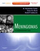 Meningiomas