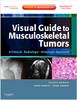 Visual Guide to Musculoskeletal Tumors: A Clinical - Radiologic - Histologic Approach - 9781437703030