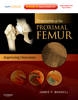 Fractures of the Proximal Femur: Improving Outcomes: Expert Consult: Online, Print and DVD - 9781437706956
