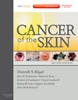 Cancer of the Skin - 9781437717884