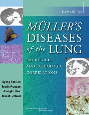 Muller's Diseases of the Lung - 9781451111163