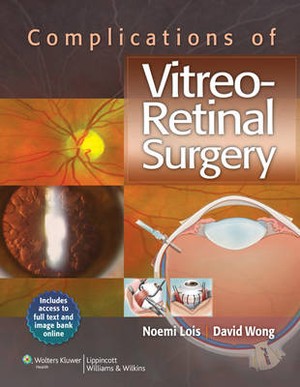 Complications of Vitreo-retinal Surgery - 9781451119381