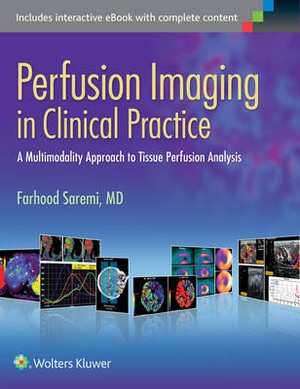 Perfusion Imaging in Clinical Practice - 9781451193169