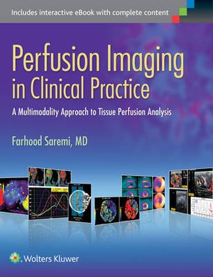 Perfusion Imaging in Clinical Practice