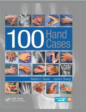 100 Hand Cases - 9781482244502