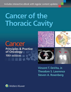 Cancer of the Thoracic Cavity - 9781496333957