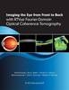 Imaging the Eye from Front to Back with RTVue Fourier-Domain Optical Coherence Tomography - 9781556429637