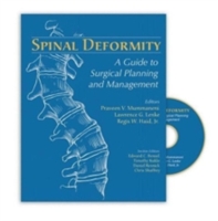 Spinal Deformity - 9781576261897