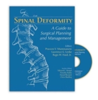 Spinal Deformity