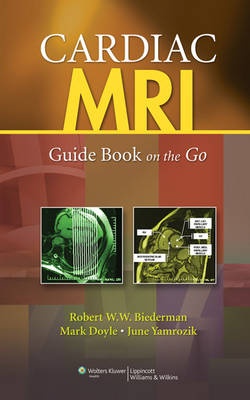 Cardiac MRI: Guide Book on the Go - 9781605476063