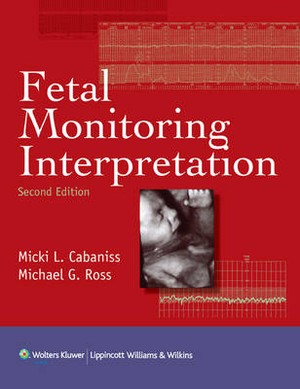 Fetal Monitoring Interpretation - 9781608313815