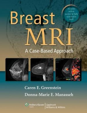 Breast MRI - 9781609132361