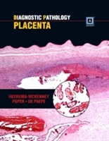 Diagnostic Pathology: Placenta - 9781937242220
