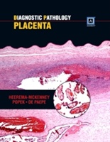 Diagnostic Pathology: Placenta