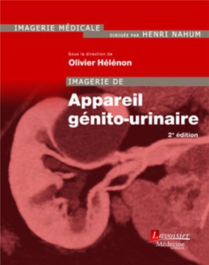 Imagerie de l'Appareil Génito-urinaire - 9782257205315
