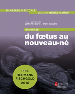 Imagerie : Du Foetus Au Nouveau-né - 9782257206510
