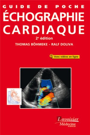 Guide de poche d'échographie cardiaque - 9782257206671