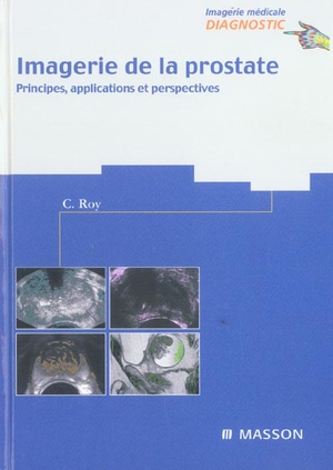 Imagerie De La Prostate ; Principes, Applications Et Perespectives - 9782294013782