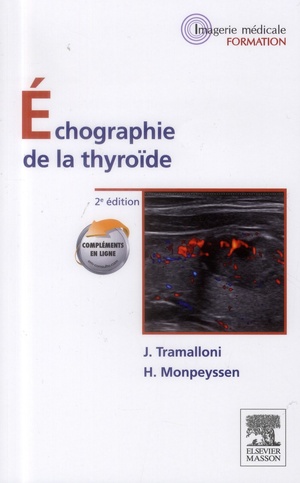 Echographie de la Thyroïde - 9782294711282