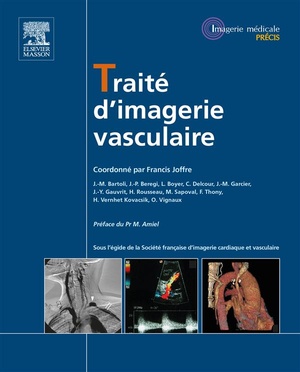 Traité D'imagerie Vasculaire - 9782294714856
