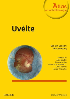 Uvéite - 9782294744686