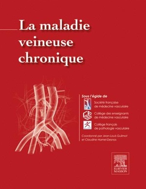 La Maladie Veineuse Chronique - 9782294744907