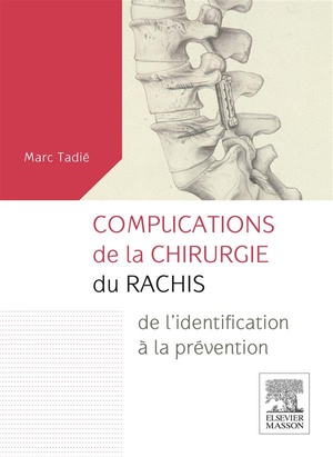 Complications de la Chirurgie du Rachis - 9782294745621