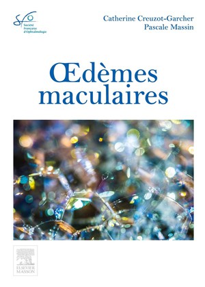 Oedèmes Maculaires