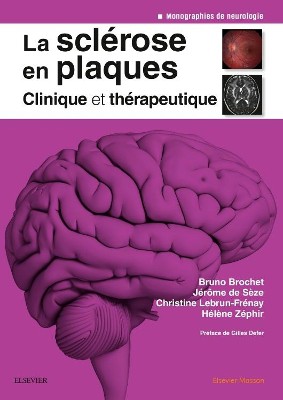 La sclérose en plaques - 9782294750205