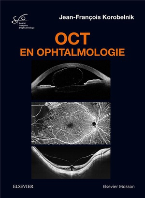 OCT en Ophtalmologie - 9782294760846
