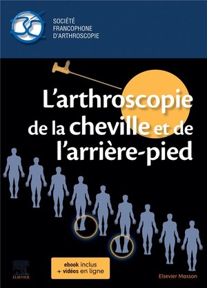 L'arthroscopie de la cheville et de l'arrière-pied - 9782294766626