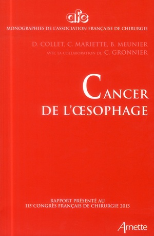 Cancer de l'oesophage